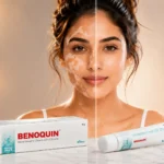 Benoquin Monobenzone Cream USP 20% w/w 30gr In Dubai